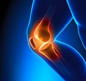 膝蓋關節炎治療